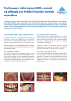 Trattamento dell'ipersensibilità dentinale: il gel al fluoro Profisil monodose unisce comfort ed efficacia