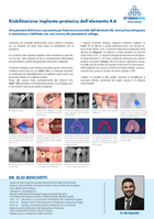 Inserimento di un impianto sul dente 46