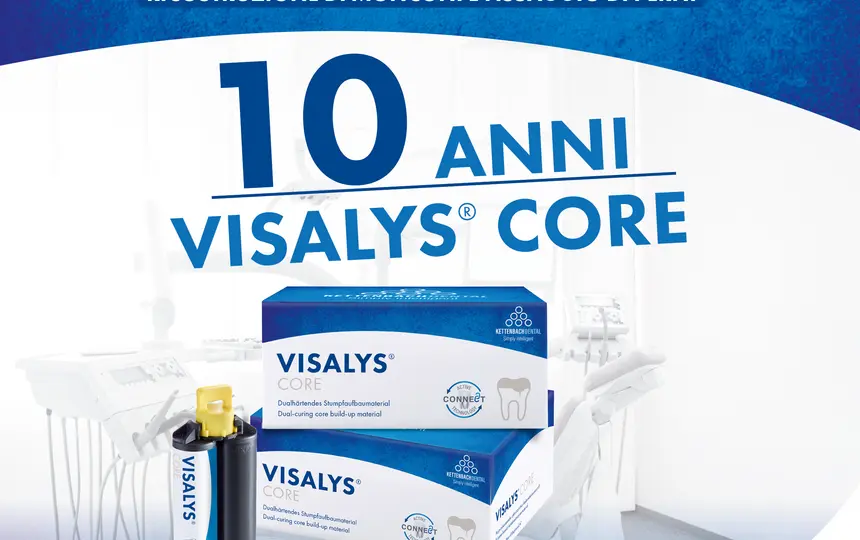 Risultati stabili con 10 anni di Visalys® Core. Ricostruzione del monconi e fissagio di perni.